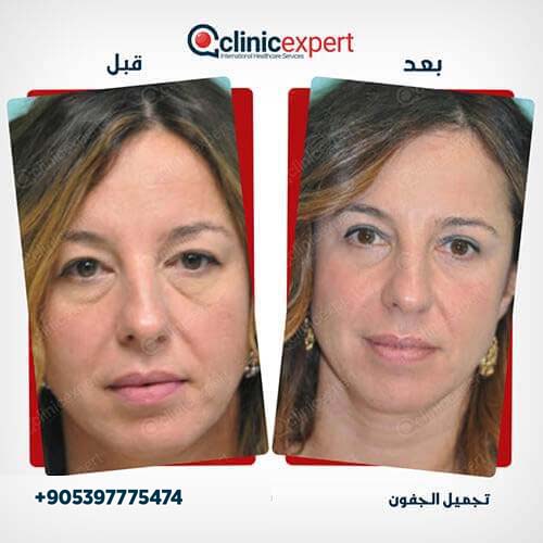 Clinic Expert Aesthetic