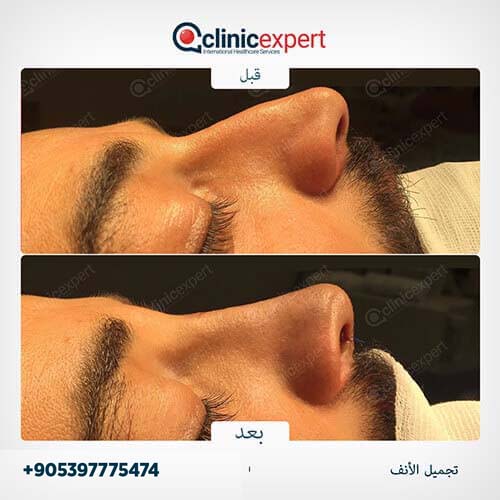 Clinic Expert Aesthetic