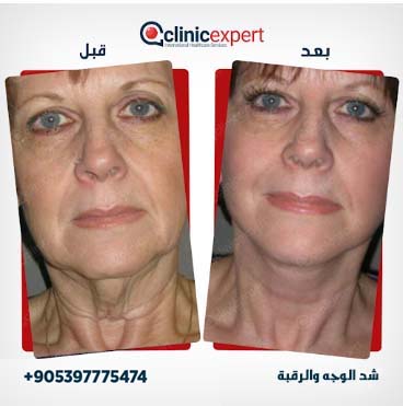 Clinic Expert Aesthetic