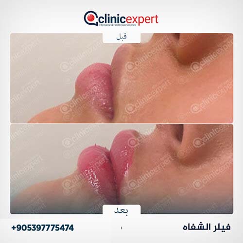 Clinic Expert Aesthetic