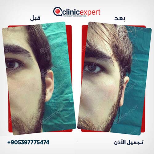 Clinic Expert Aesthetic