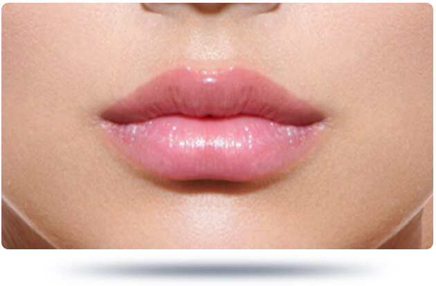تجميل الشفاه