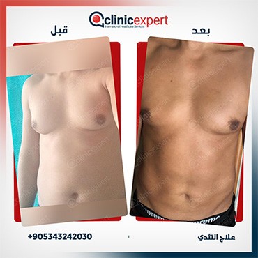 Clinic Expert Aesthetic