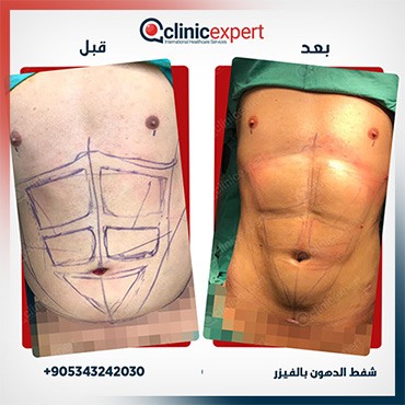 Clinic Expert Aesthetic