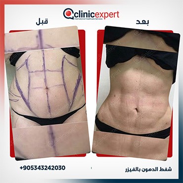 Clinic Expert Aesthetic