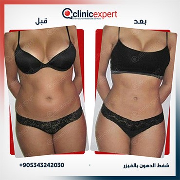 Clinic Expert Aesthetic