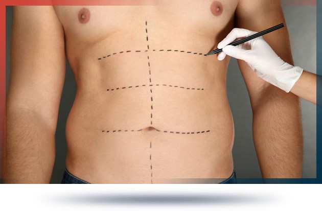 ازالة الدهون