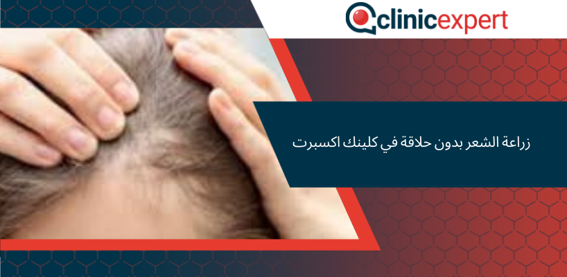 زراعة الشعر بدون حلاقة