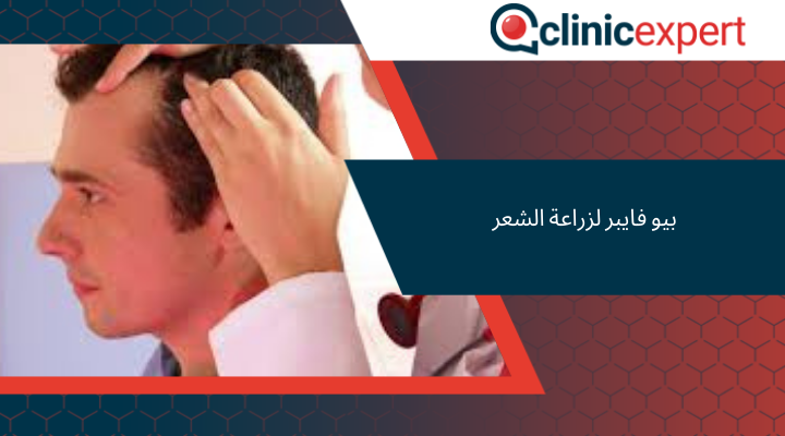 بيو فايبر لزراعة الشعر‎