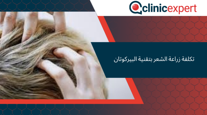 تكلفة زراعة الشعر بتقنية البيركوتان