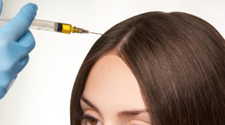 تكلفة زراعة الشعر بالخلايا الجذعية