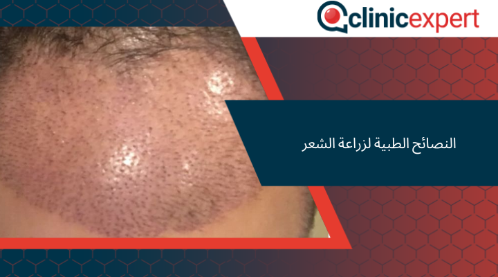 النصائح الطبية لزراعة الشعر