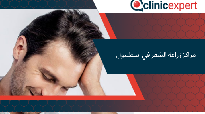 مراكز زراعة الشعر في اسطنبول