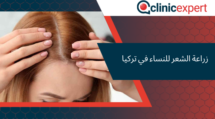 زراعة الشعر للنساء في تركيا