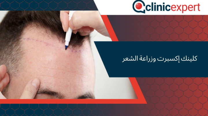 كلينك إكسبرت وزراعة الشعر