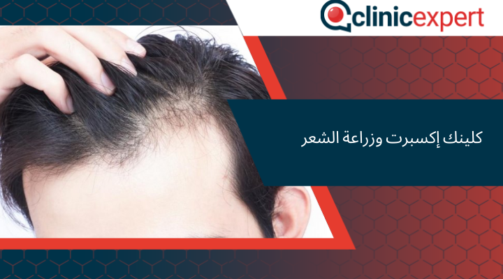 كلينك إكسبرت وزراعة الشعر