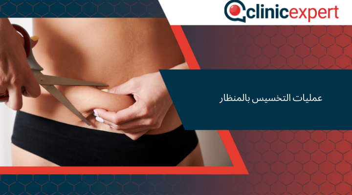 عمليات التخسيس بالمنظار