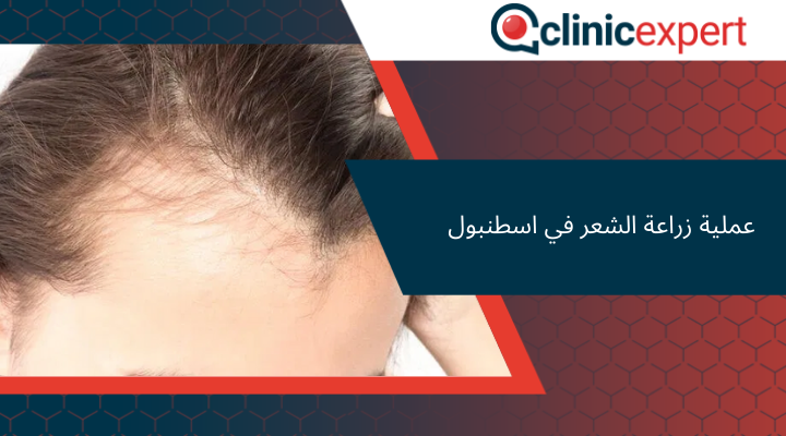 عملية زراعة الشعر في اسطنبول