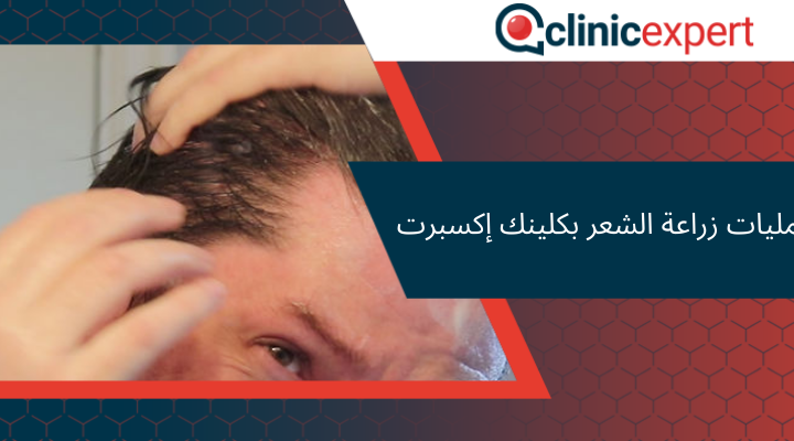 عمليات زراعة الشعر بكلينك إكسبرت