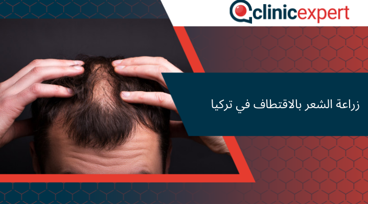 زراعة الشعر بالاقتطاف في تركيا