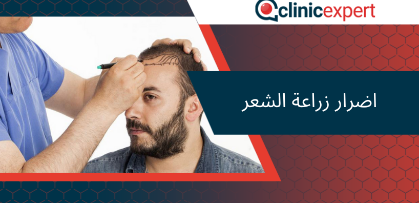 اضرار زراعة الشعر