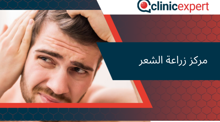 مركز زراعة الشعر