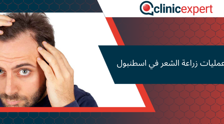 عمليات زراعة الشعر في اسطنبول