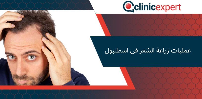 عمليات زراعة الشعر في اسطنبول