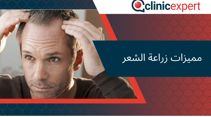 مميزات زراعة الشعر