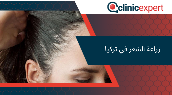 زراعة الشعر في تركيا