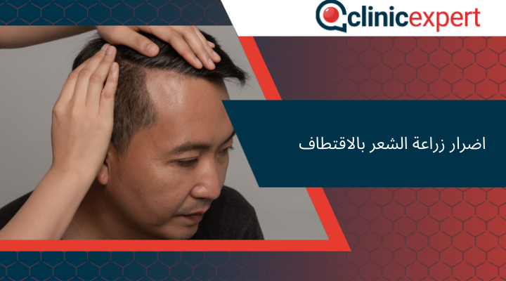 اضرار زراعة الشعر بالاقتطاف