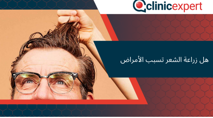 هل زراعة الشعر تسبب الأمراض!