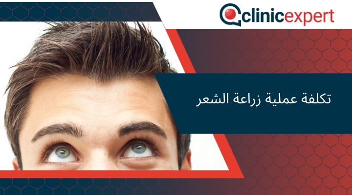 تكلفة عملية زراعة الشعر