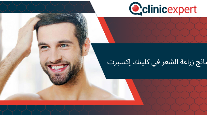  نتائج زراعة الشعر في كلينك إكسبرت