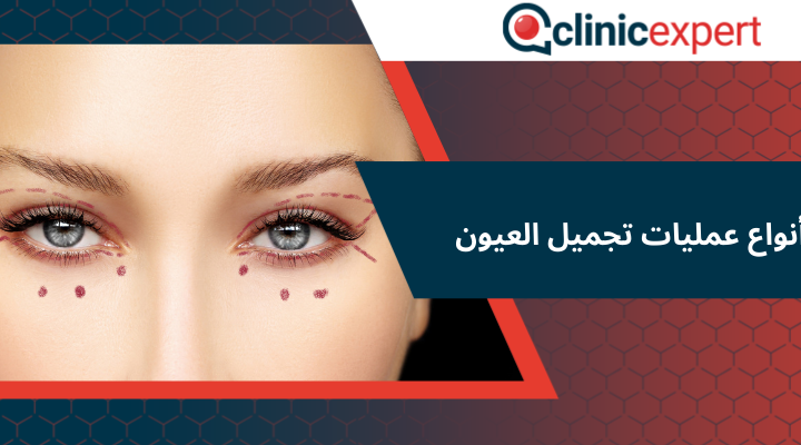 أنواع عمليات تجميل العيون