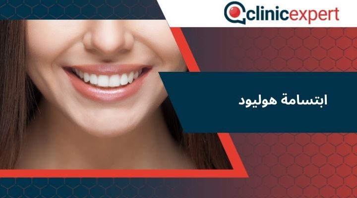 ابتسامة هوليود