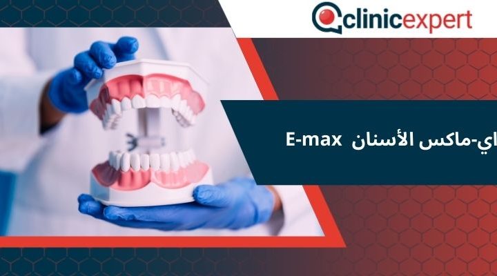  اي-ماكس الأسنان E-max