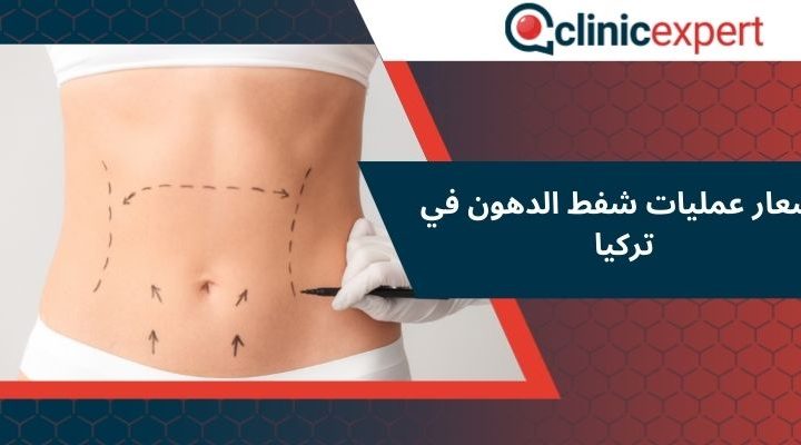 أسعار عمليات شفط الدهون في تركيا