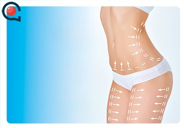 Abdominoplastie (Bauchstraffung)