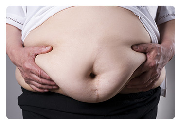 MAGEN HÜLSEN CHIRURGIE