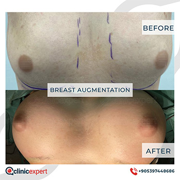 Clinic Expert Aesthetic Clinic Expert Aesthetic