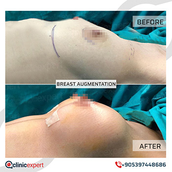 Clinic Expert Aesthetic Clinic Expert Aesthetic