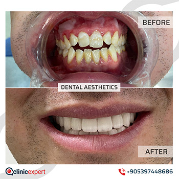 Clinic Expert Aesthetic Clinic Expert Aesthetic