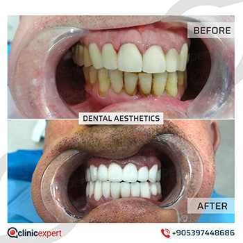 Clinic Expert Aesthetic Clinic Expert Aesthetic