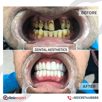 Clinic Expert Aesthetic Clinic Expert Aesthetic