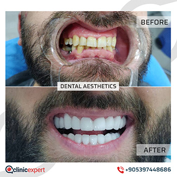 Clinic Expert Aesthetic Clinic Expert Aesthetic