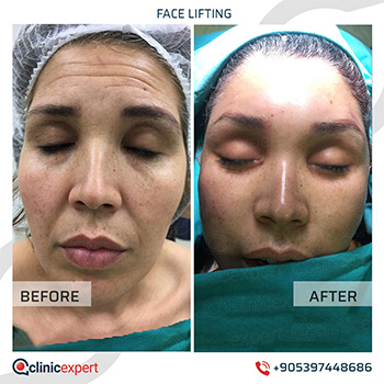 Clinic Expert Aesthetic Clinic Expert Aesthetic