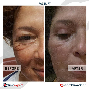 Clinic Expert Aesthetic Clinic Expert Aesthetic