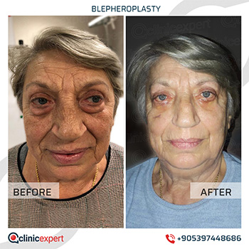 Clinic Expert Aesthetic Clinic Expert Aesthetic