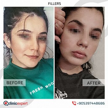 Clinic Expert Aesthetic Clinic Expert Aesthetic